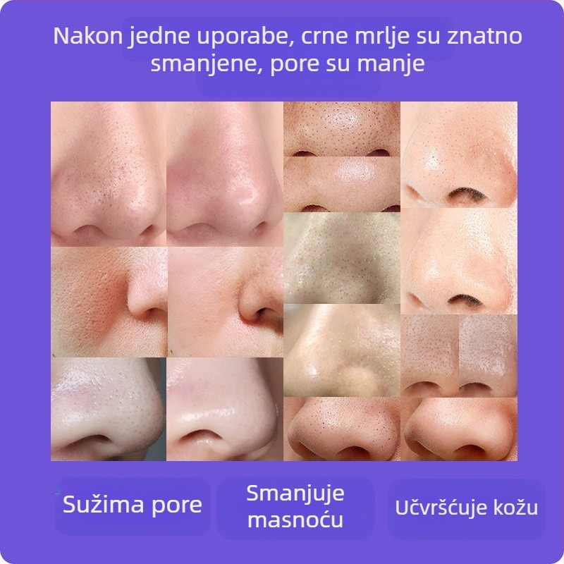 Vizualni uređaj za uklanjanje crnih mrlja — ručni s ultrazvučnim djelovanjem, model ZM613, ABS kućište, 3 razine postavki