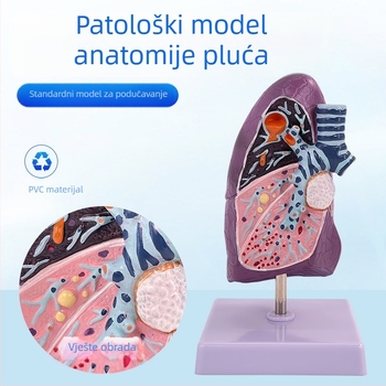 Blue Butterfly plastični model unutarnjih organa: dušnik i pluća - anatomija s patologijom i presjek pluća pušača.