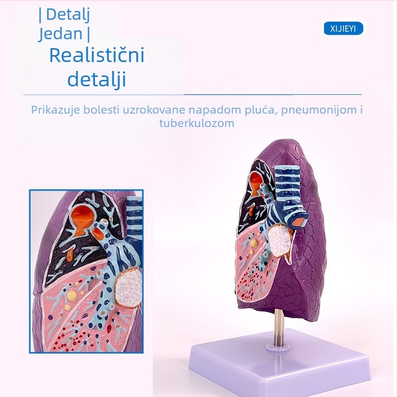 Blue Butterfly plastični model unutarnjih organa: dušnik i pluća - anatomija s patologijom i presjek pluća pušača.