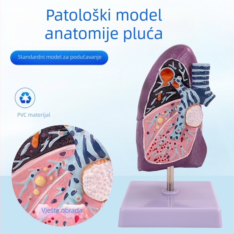 Blue Butterfly plastični model unutarnjih organa: dušnik i pluća - anatomija s patologijom i presjek pluća pušača.