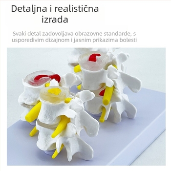 Blue Butterfly PVC četverosekleni model lumbalne kralježnice: normalni i patološki kralješci s patološkom diskom