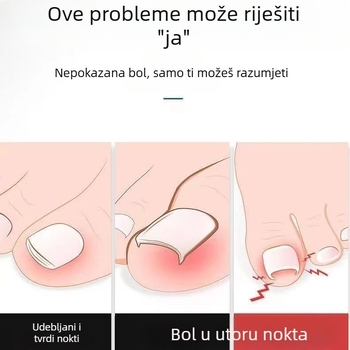 Set alata za pedikuru od nehrđajućeg čelika: kliješta za brazdu noktiju, šikimi nožicama i višenamjenske pinzete