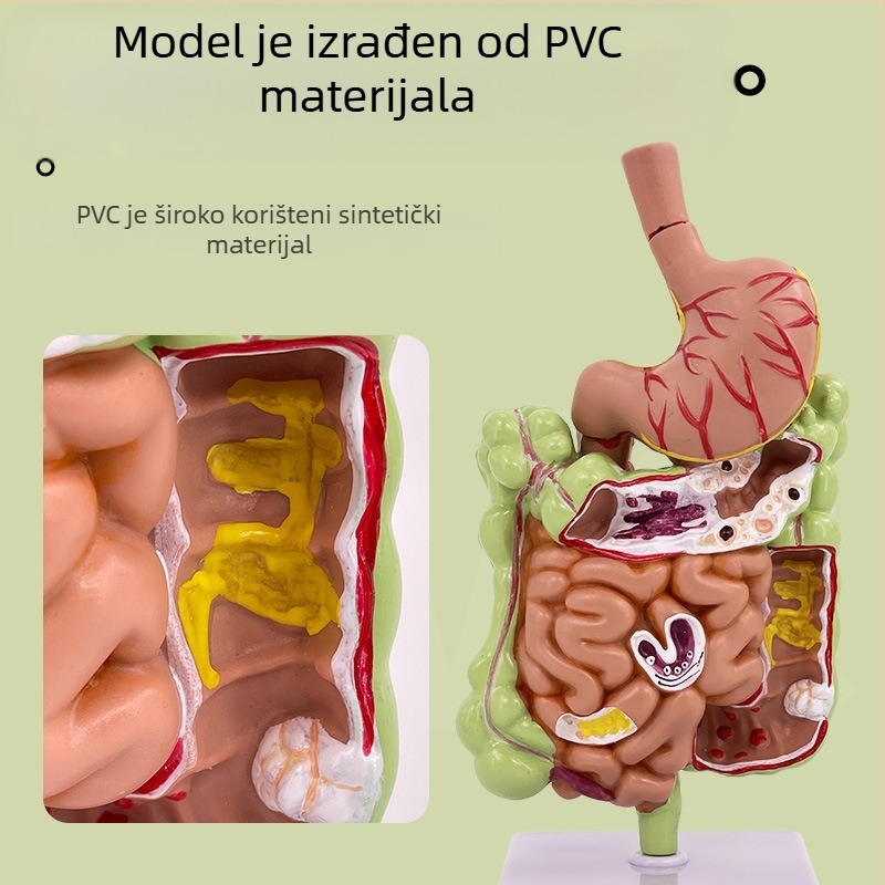 Model ljudskog želuca za anatomiju — koronarni presjek, patološki model želuca s perforacijom, edukacija iz gastroenterologije