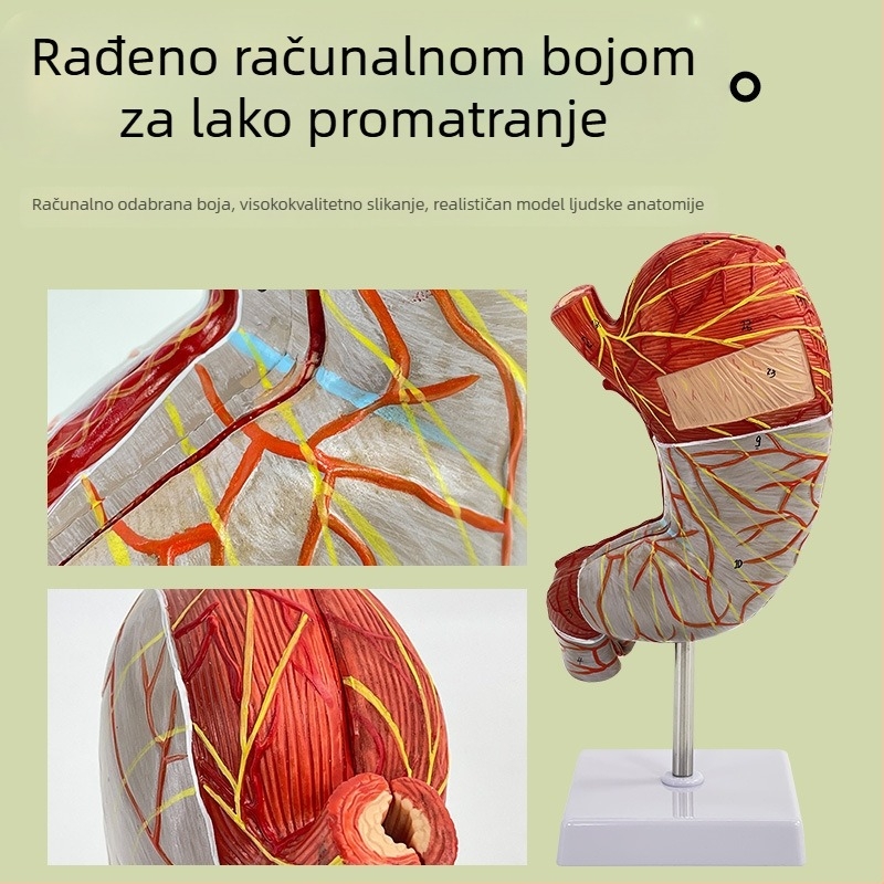 Model ljudskog želuca za anatomiju — koronarni presjek, patološki model želuca s perforacijom, edukacija iz gastroenterologije