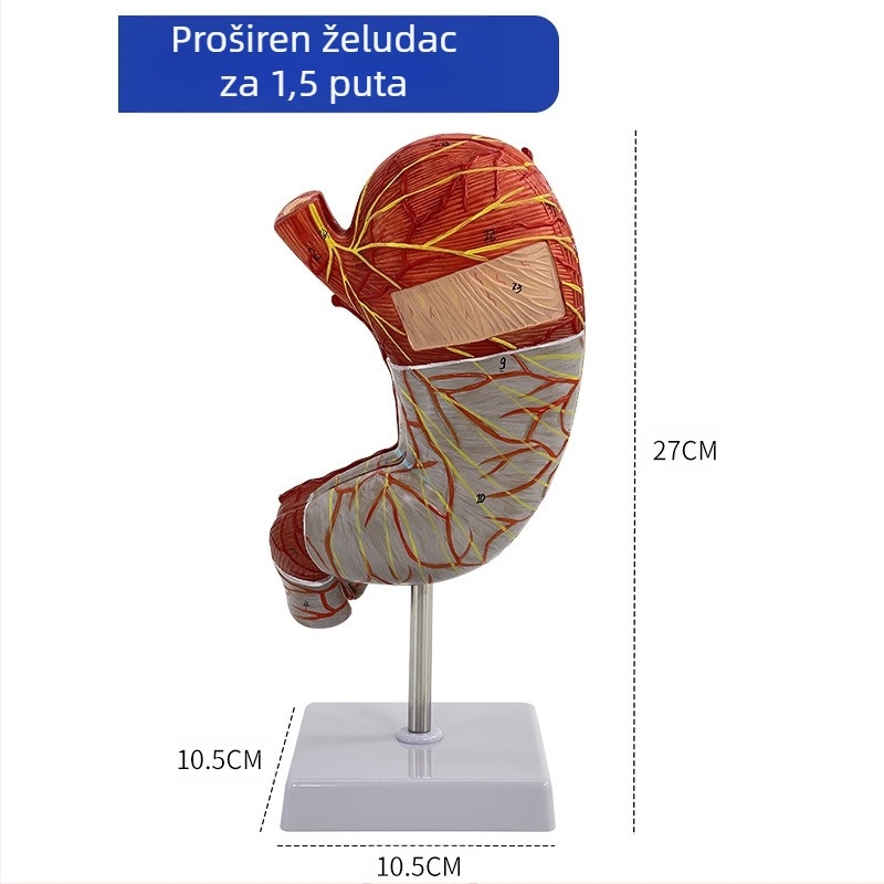 Model ljudskog želuca za anatomiju — koronarni presjek, patološki model želuca s perforacijom, edukacija iz gastroenterologije