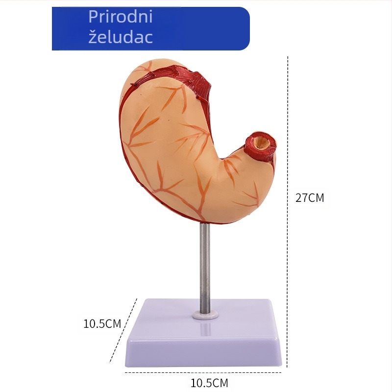 Model ljudskog želuca za anatomiju — koronarni presjek, patološki model želuca s perforacijom, edukacija iz gastroenterologije