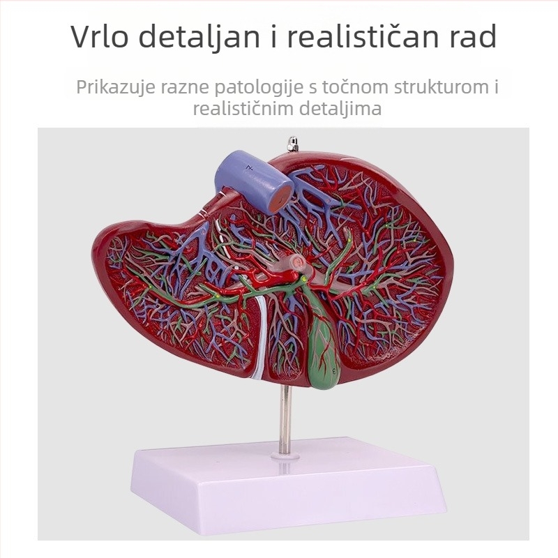 Izuzetno realističan anatomski model jetre s hepatobiliarno-pankreasno-slezinskim-duodenalnim sustavom i reljefnim lezijama
