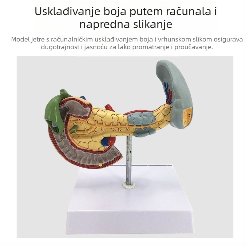 Izuzetno realističan anatomski model jetre s hepatobiliarno-pankreasno-slezinskim-duodenalnim sustavom i reljefnim lezijama