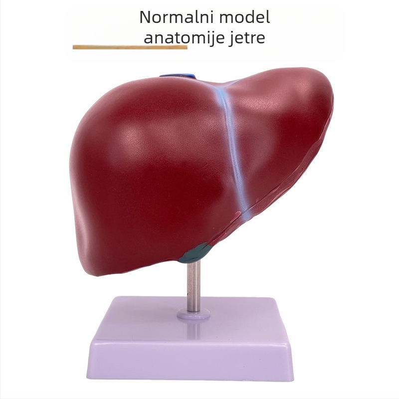 Izuzetno realističan anatomski model jetre s hepatobiliarno-pankreasno-slezinskim-duodenalnim sustavom i reljefnim lezijama