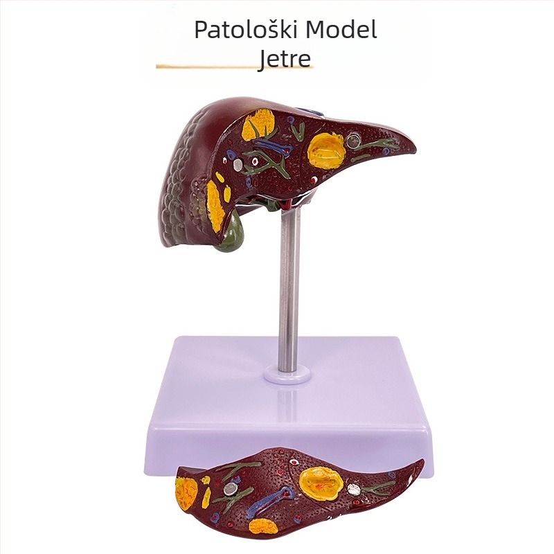 Izuzetno realističan anatomski model jetre s hepatobiliarno-pankreasno-slezinskim-duodenalnim sustavom i reljefnim lezijama