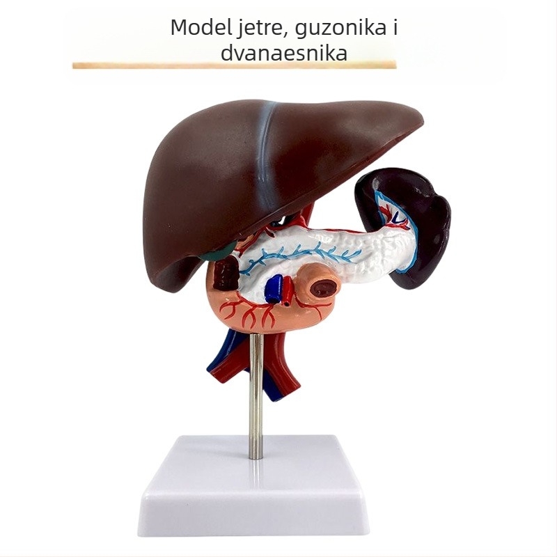 Izuzetno realističan anatomski model jetre s hepatobiliarno-pankreasno-slezinskim-duodenalnim sustavom i reljefnim lezijama