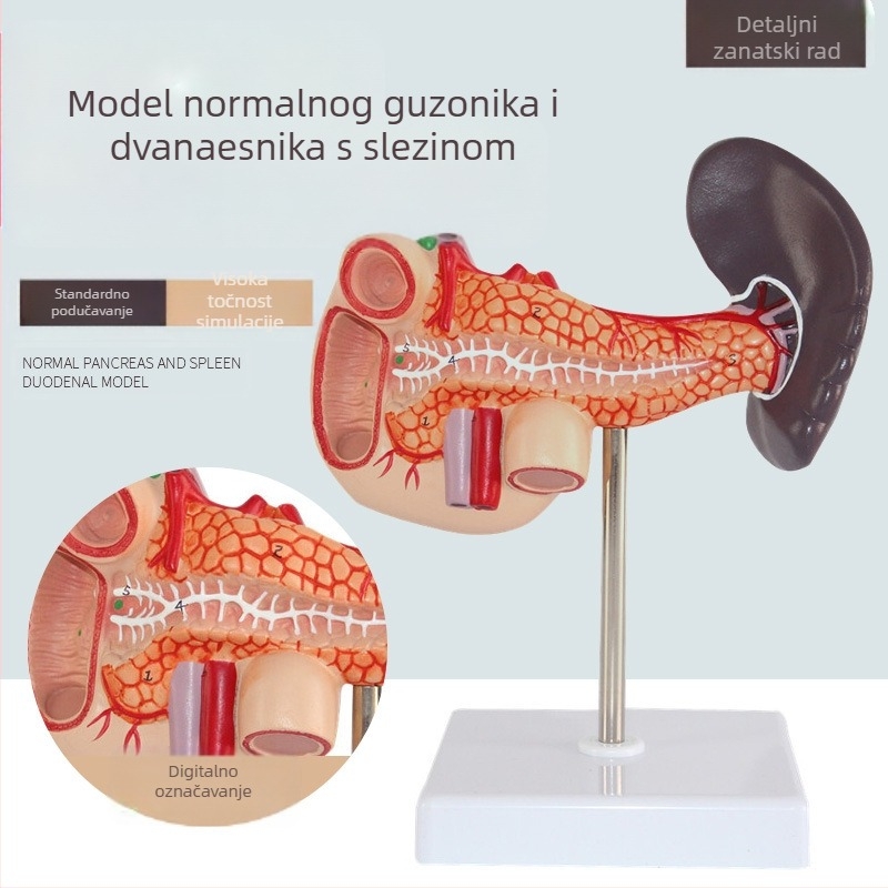Izuzetno realističan anatomski model jetre s hepatobiliarno-pankreasno-slezinskim-duodenalnim sustavom i reljefnim lezijama