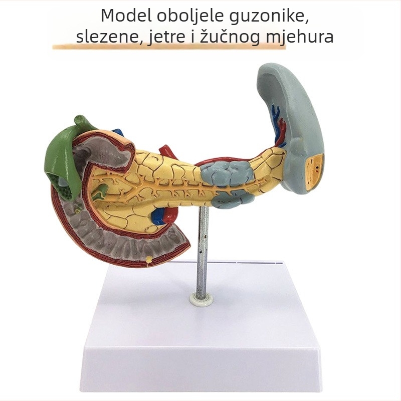 Izuzetno realističan anatomski model jetre s hepatobiliarno-pankreasno-slezinskim-duodenalnim sustavom i reljefnim lezijama