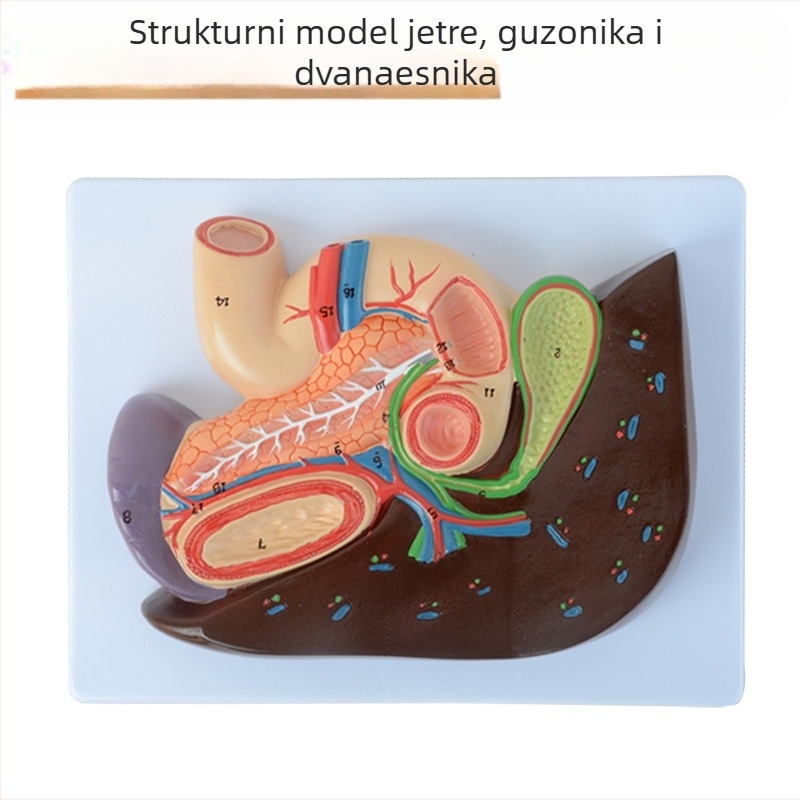 Izuzetno realističan anatomski model jetre s hepatobiliarno-pankreasno-slezinskim-duodenalnim sustavom i reljefnim lezijama