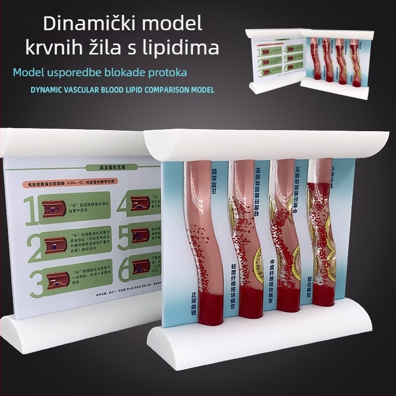 Dinamički vaskularni model od plastike s visoko gustoćnim začepljenjem i trombom plakova – nastavnički model