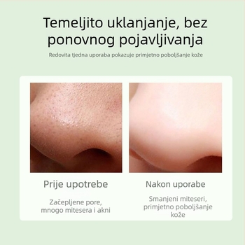 Vizualno sredstvo za čišćenje lica za uklanjanje mitesa, s HD prikazom i usisavanjem za dubinsko čišćenje pora