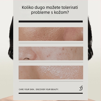 Chise Maska s malim oksigenovim mjehurićima – gel-krema maska za lice, čišćenje i hidratacija, regulacija masnoće