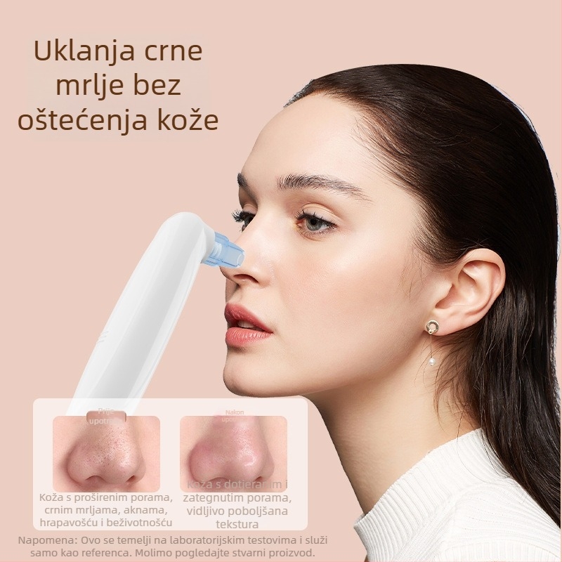 HF-001 ultrazvučni uređaj za uklanjanje crnih mitiser, 3 brzine, kućište ABS+PS