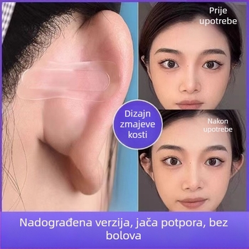 Leptir ušna pločica s čvrstom potporom — nevidljiva kontura lica, korekcija ušiju za žene