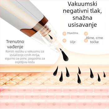 Aparat za usisavanje crnih točkica, električni kućni kozmetički uređaj, model 5678, 3. stupanj prijenosa