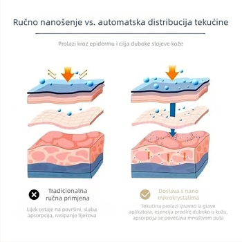 Uređaj za rast kose s vodnim svjetlom – ručni kozmetički alat s mikrokrystalnim perom, baterija 2000–4000 mAh, IPX3, prijenosno