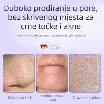 Profesionalni kozmetički alat od nehrđajućeg čelika: klipsa za akne tip ćelije, delfin klip, porijeklo Yangjiang, trajanje 5 godina