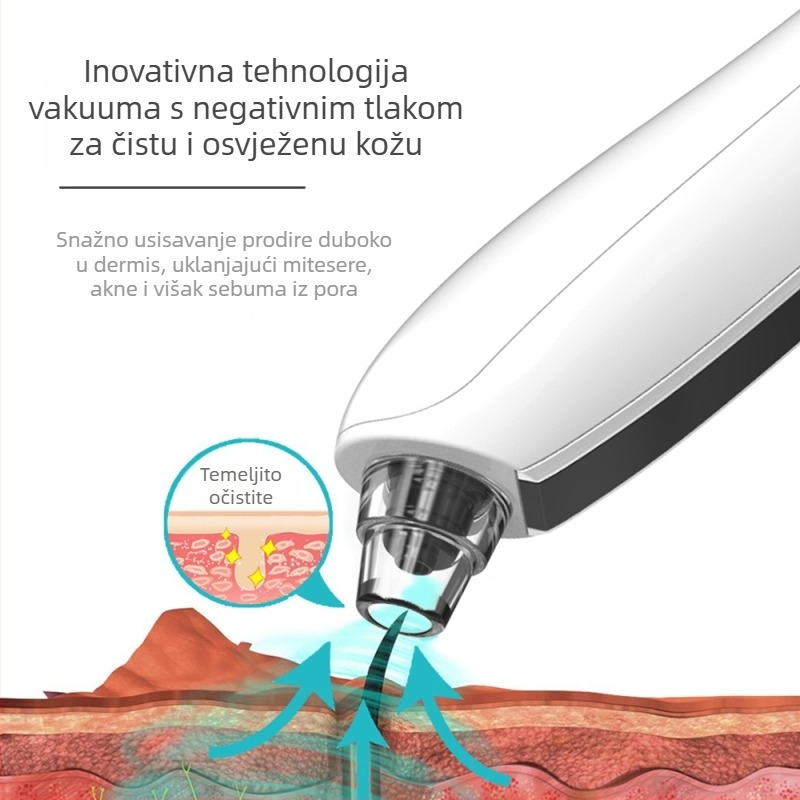 Električni uređaj za čišćenje pora s вакуумом, 3 brzine, kućna upotreba, vizualni zaslon za crne točkice
