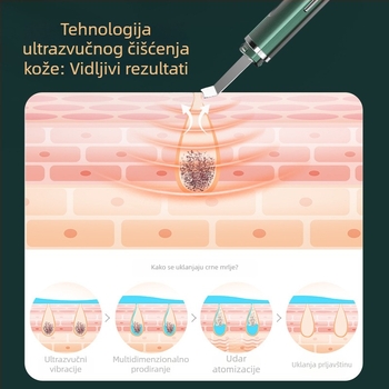 Ultrazvučni kozmetički uređaj s ionnim uvodom, model C62, uklanja crne točkice i vrši iontni uvod, EMS mikrostruja, 3 postavke, ABS kućište