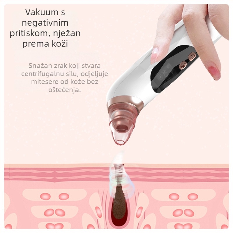 SY KS20012 Vakumski odstranjivač crnih mrlja, električna adsorpcija, 2 stupnja