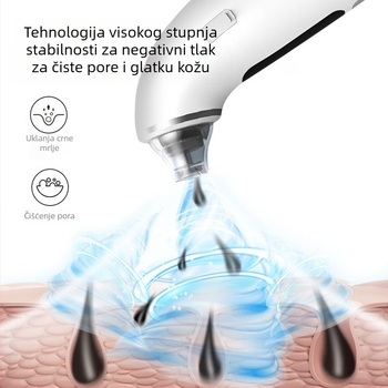 Uređaj za čišćenje lica, električni način rada, model XQP-001, 4 stupnja brzine, fizička adsorpcija, ABS kućište.