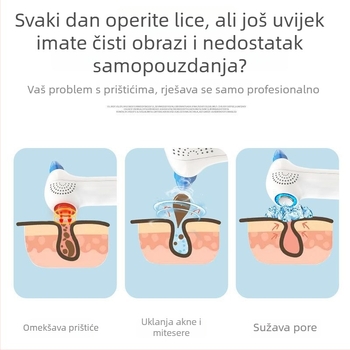 DYM vakuumski uređaj za uklanjanje crnih mitesa, električna rotacija, dvostruki režim toplo/hladno, crveno/plava svjetlost, ABS kućište, 5 brzina