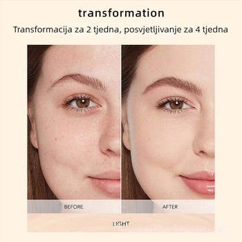 Xin Phil uređaj za lice – maska za njegu kože s infracrvenom i bojnom svjetlosnom terapijom, uklanjanje bora, prijenosno, IPX3 vodootpornost.