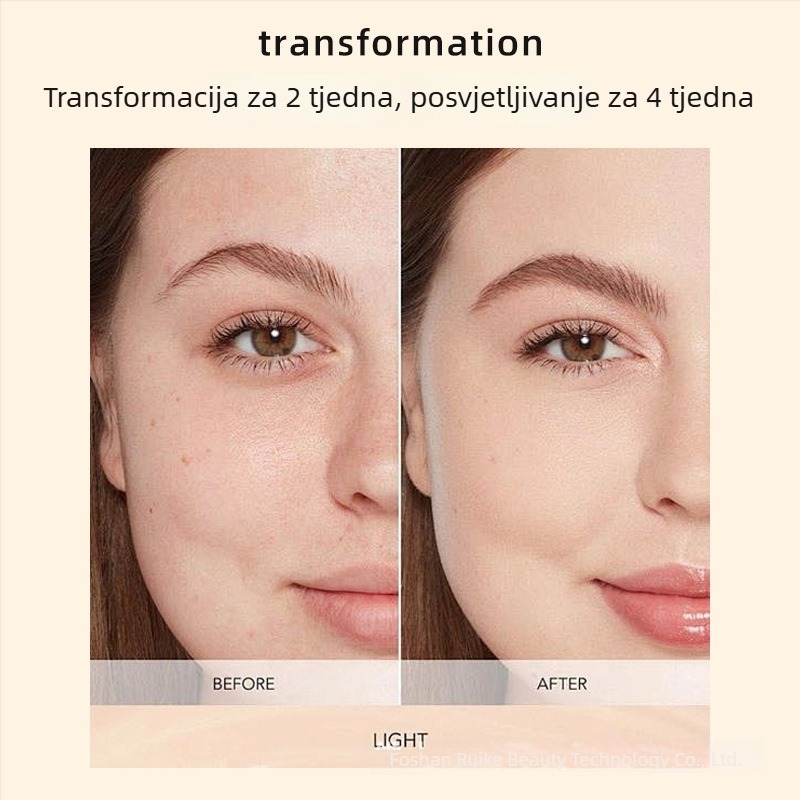 Xin Phil uređaj za lice – maska za njegu kože s infracrvenom i bojnom svjetlosnom terapijom, uklanjanje bora, prijenosno, IPX3 vodootpornost.