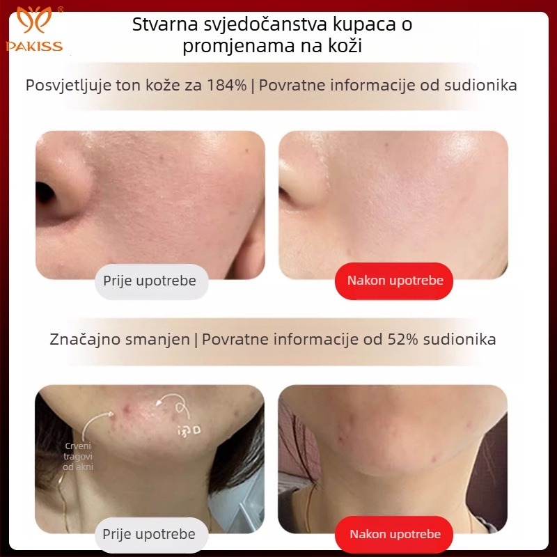 Uređaj za pomlađivanje kože LED fototerapijom, prenosiv, IPX5 vodootporan, vanjski pogon, za kućnu upotrebu