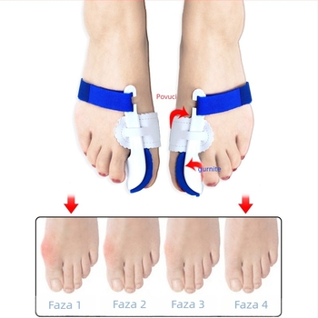 Medicinski ortoz za hallux valgus s dijeličem prstiju, model ZBHL24; materijali EVA, najlon, magijski remen, PU koža, PP; marka High foot family
