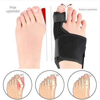 Zaštitna rukav na palac nožnog s unutarnjim i vanjskim separatorima; materijali: OK tkanina, SBR, poliester, aluminijska traka, silikon, Velcro; marka Foot Product Collection; korištenje tijekom cijele godine.