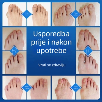 Podesivi korektor za palac za hallux valgus | Visokokvalitetna pamuk tkanina | Marka Junzukang | Pogodno za sve sezone