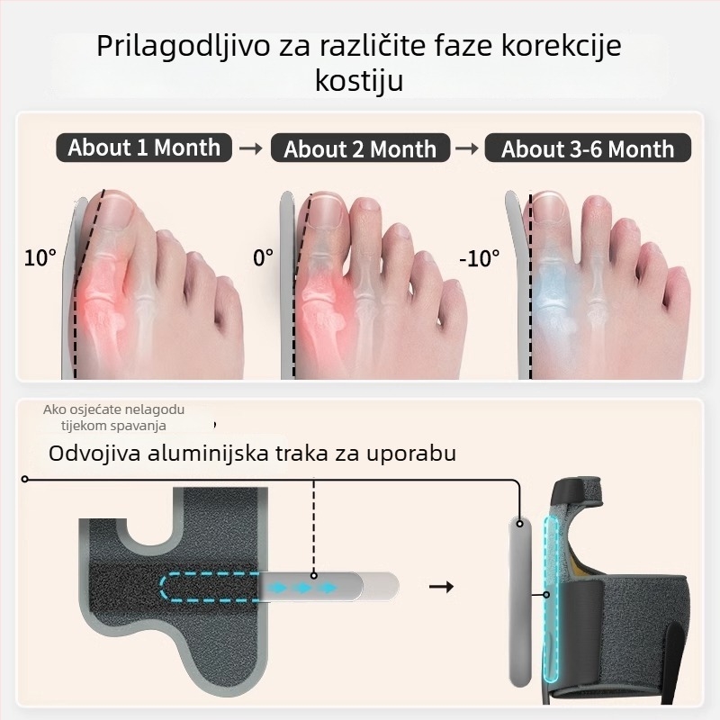 Hallux valgus ortoza s odjeljivačem prsta i aluminijskom trakom podrškom | Model 24-M-002 | Prozračan materijal + Velcro