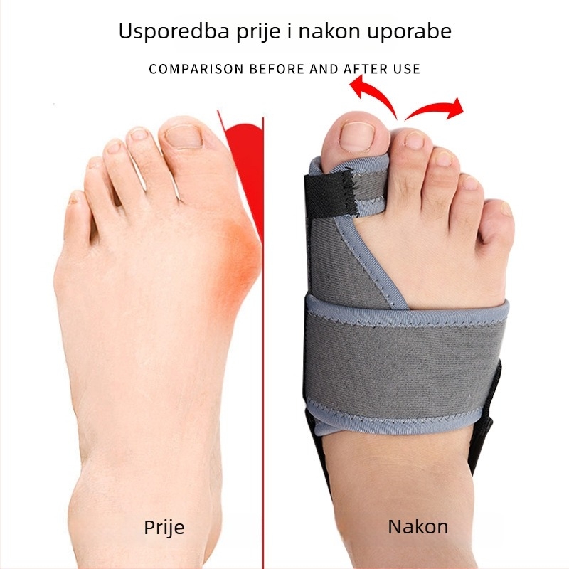 Orteza za korekciju hallux valgus s podesivim remenom, aluminijskom pločom i razdjelnikom prstiju