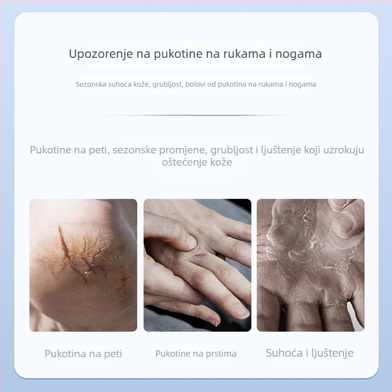 Prozračni patch za ispucalu kožu ruku i stopala, platneni Band-Aid, protuklizna funkcija, rok trajanja 2 godine, univerzalna primjena, pojedinačno pakirano