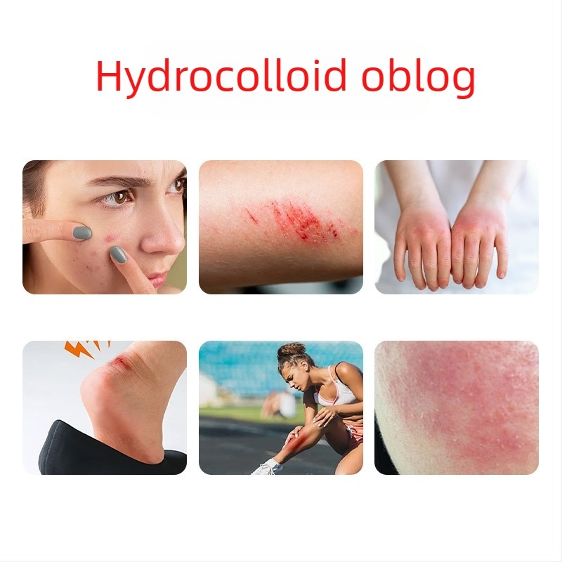 Hidro-koloidni zavoj u roli s rubom za petu, debljina 0,3 mm, hidro-koloidni materijal, mogućnost ispisa logotipa, prilagodba dostupna