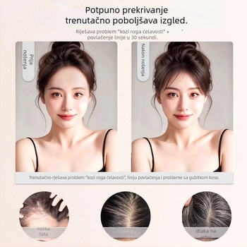 Dio peruke za volumen na vrhu glave – pravo vlasi, duljina 25 cm, model 7×11 Qingyun, potpuno ručno tkan