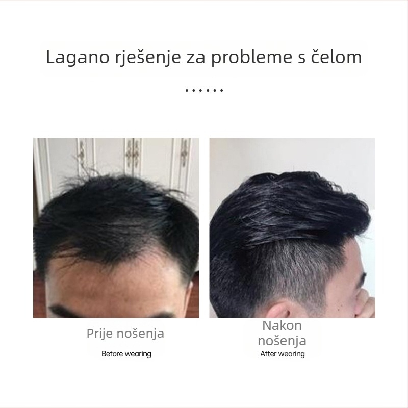 Hengyang Muški patch za čelo – ručno tkan, od pravih vlasi
