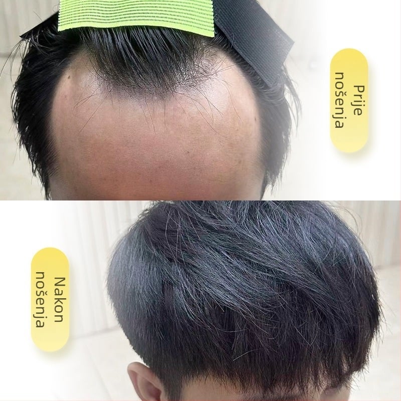 Patch linije kose s M oblikom za muškarce i žene, ručno tkan, ljudska kosa, ravna, može se bojiti ili peglati