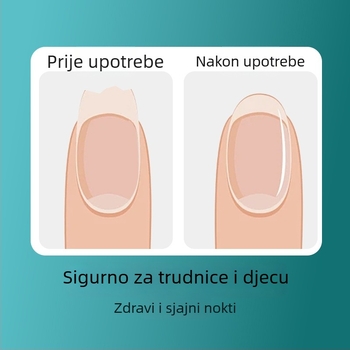 Set alata za manikuru s kliještima i škaricama za nokte, Anti-Splash dizajn