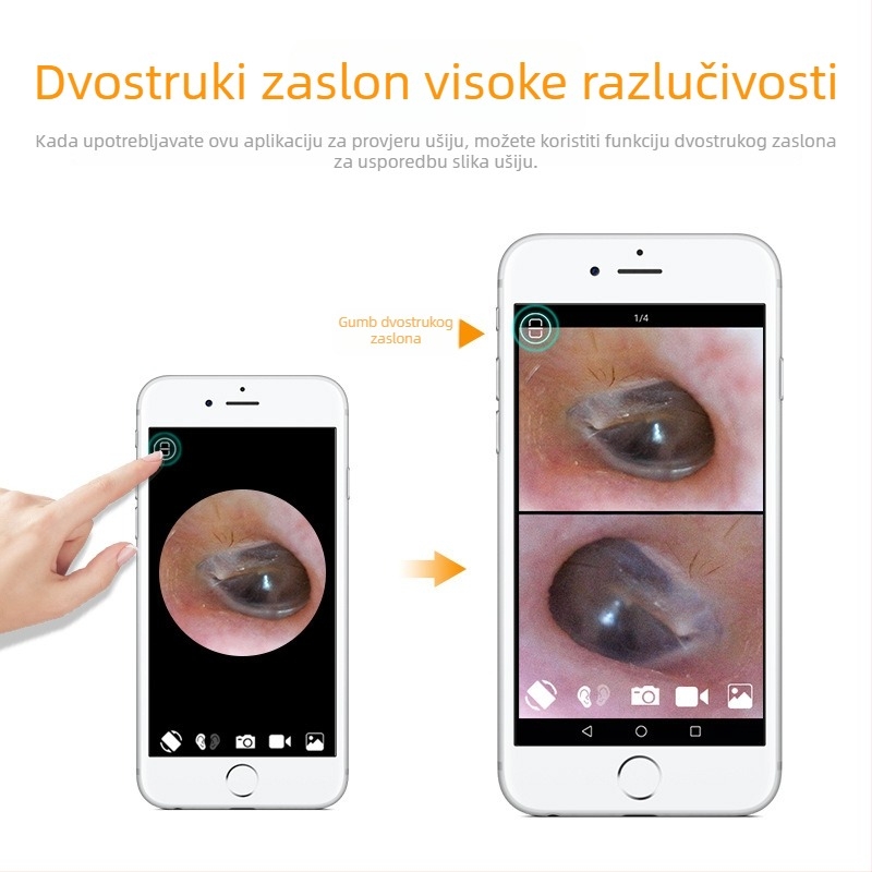 Bežični Wi-Fi ušni endoskop za kućnu upotrebu s vizualnom kamerom za čišćenje uha
