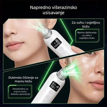 Električni rotirajući uređaj za čišćenje lica i uklanjanje prištića, prijenosni ekstraktor pora za akne