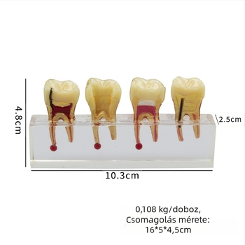 Oktatási modell a gyerekek tejfoga kariesséhez és pulpa javításához; GC OEM; 108 g; vonalkód 236; Importált: Nem