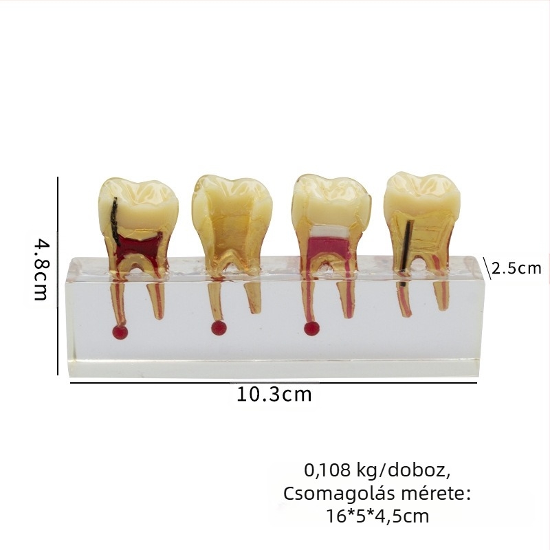 Oktatási modell a gyerekek tejfoga kariesséhez és pulpa javításához; GC OEM; 108 g; vonalkód 236; Importált: Nem