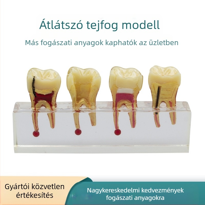 Oktatási modell a gyerekek tejfoga kariesséhez és pulpa javításához; GC OEM; 108 g; vonalkód 236; Importált: Nem